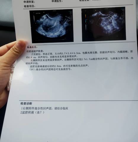 journal_insert_pic_1680118046