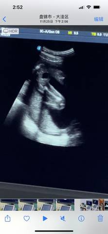 journal_insert_pic_1677719816