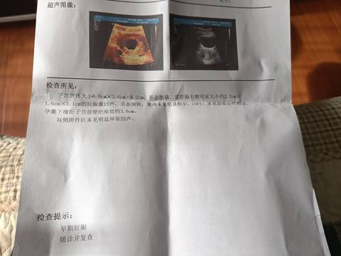 journal_insert_pic_1673441042