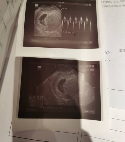 journal_insert_pic_1685826970