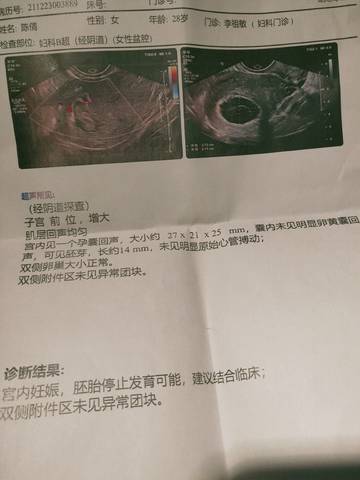 journal_insert_pic_1684842963