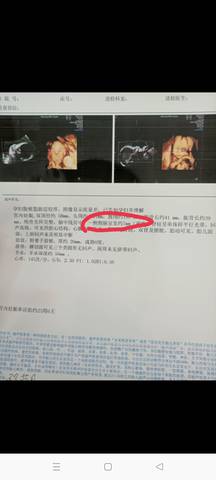 journal_insert_pic_1674664902