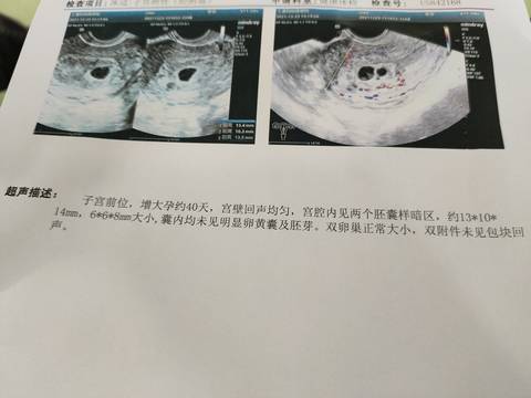 journal_insert_pic_1684791985