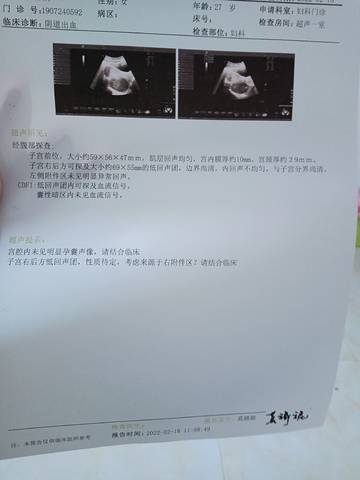 journal_insert_pic_1719605352