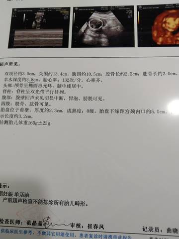journal_insert_pic_1688186934