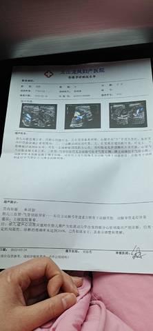 journal_insert_pic_1719790255