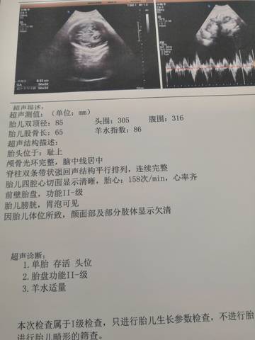 journal_insert_pic_1674799080