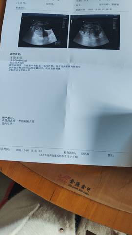 journal_insert_pic_1674955510