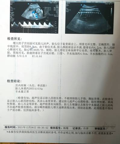 journal_insert_pic_1674841282