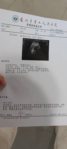 journal_insert_pic_1682731403