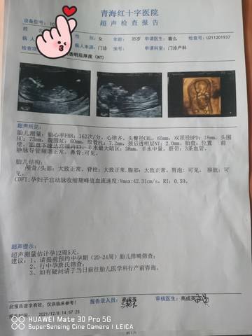 journal_insert_pic_1686662996