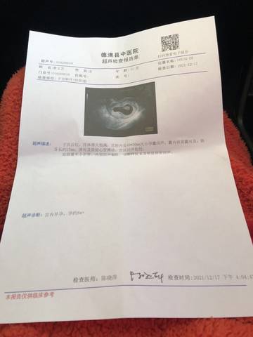 journal_insert_pic_1682543419