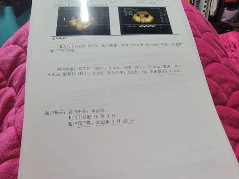 journal_insert_pic_1675622603