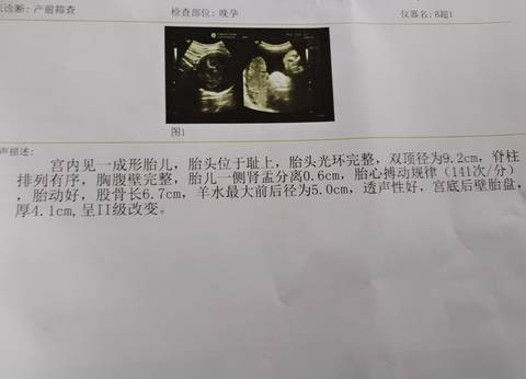 journal_insert_pic_1686562767