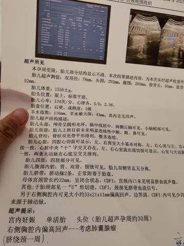 journal_insert_pic_1677540378
