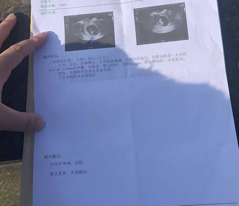 journal_insert_pic_1719430622