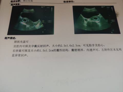 journal_insert_pic_1682591421