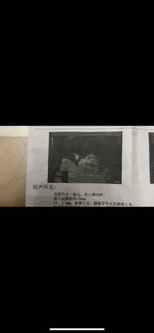 journal_insert_pic_1684810354