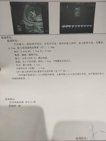 journal_insert_pic_1674661122
