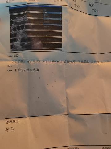 journal_insert_pic_1719730085