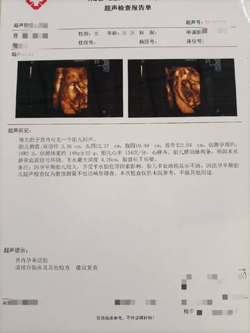 journal_insert_pic_1675258906