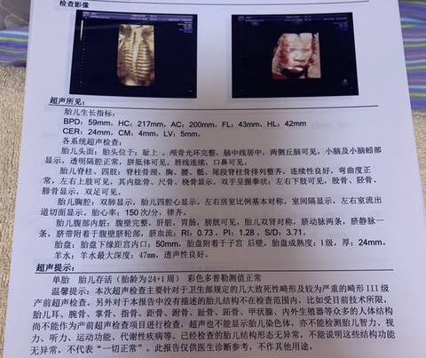 journal_insert_pic_1690470675
