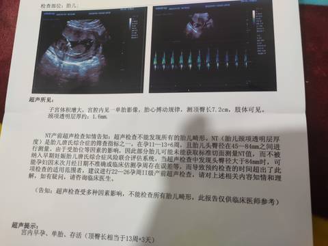 journal_insert_pic_1690295581