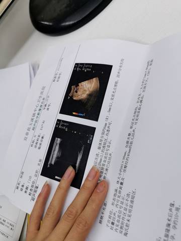 journal_insert_pic_1690038488