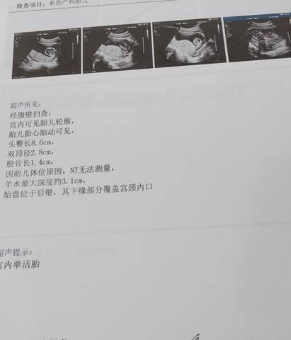 journal_insert_pic_1679206440