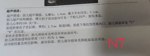 journal_insert_pic_1679196806