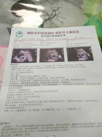 journal_insert_pic_1681190650