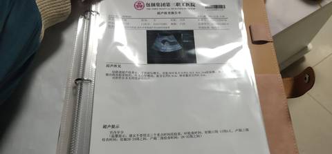 journal_insert_pic_1689399076