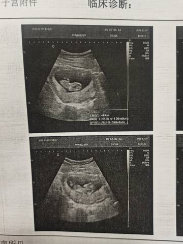 journal_insert_pic_1675676350