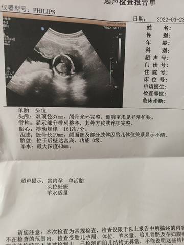 journal_insert_pic_1741085046