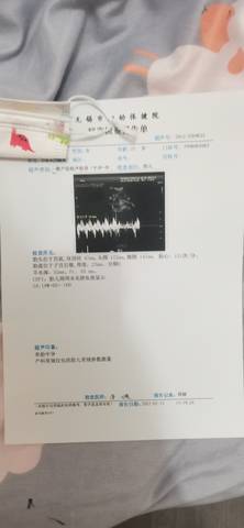 journal_insert_pic_1719533122