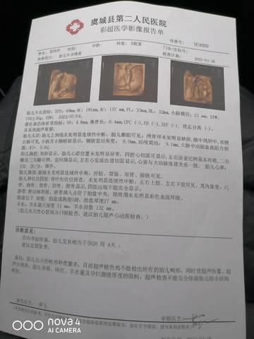 journal_insert_pic_1719397464