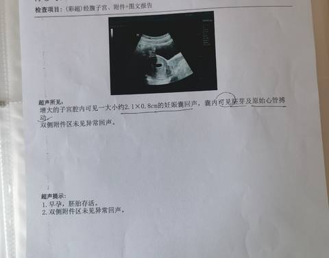 journal_insert_pic_1685330782