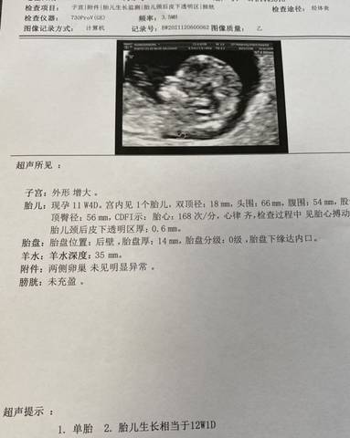 journal_insert_pic_1678321816