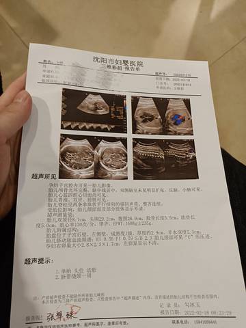journal_insert_pic_1719621202