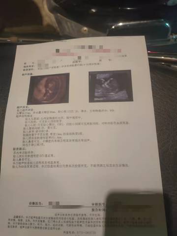 journal_insert_pic_1677750726