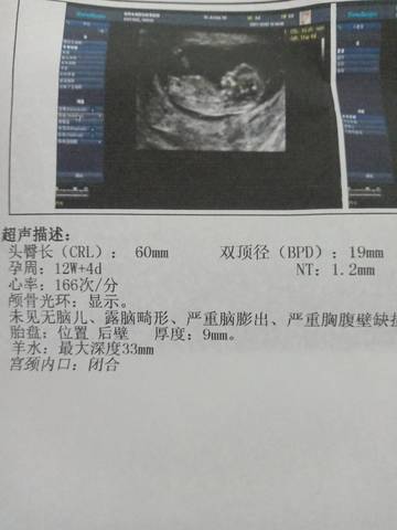 journal_insert_pic_1686140150