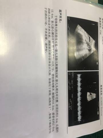 journal_insert_pic_1684810783