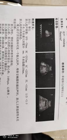 journal_insert_pic_1678572815