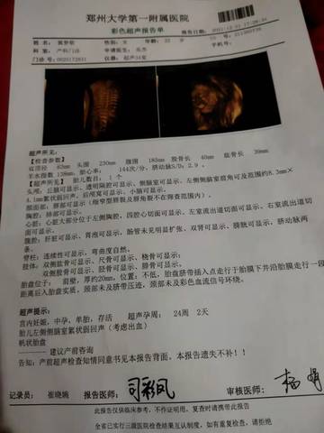journal_insert_pic_1689725305