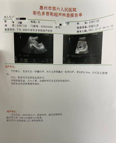 journal_insert_pic_1675542940