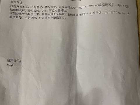 journal_insert_pic_1689695892