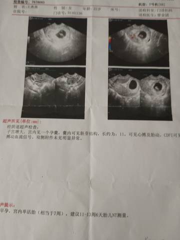 journal_insert_pic_1686098615