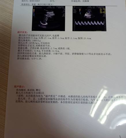 journal_insert_pic_1686327651