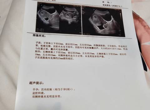 journal_insert_pic_1682307810