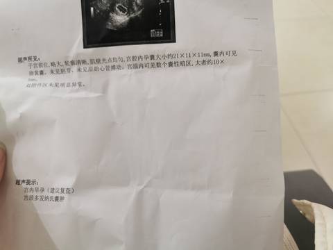 journal_insert_pic_1677409448